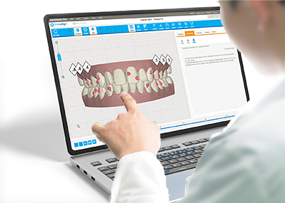 Invisalign ClinCheck Sanfte Kieferorthopädie Dr. Ana Torres Moneu, Dr. Christoph Moschik · relax & smile