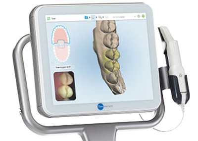 Der Kieferscanner - Itero Element Sanfte Kieferorthopädie Dr. Ana Torres Moneu, Dr. Christoph Moschik · relax & smile